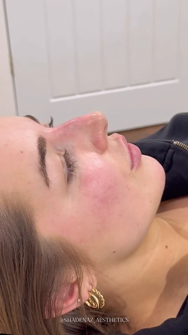 Post 9 by SA - Shadenaz Aesthetics on Instagram (video)