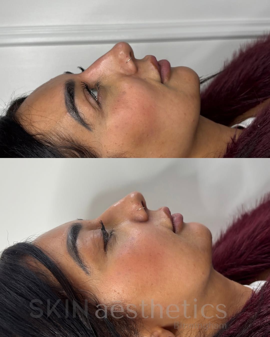 Post 1 by SKIN AESTHETICS & TRAINING | Aleesha Thompson on Instagram (image)
