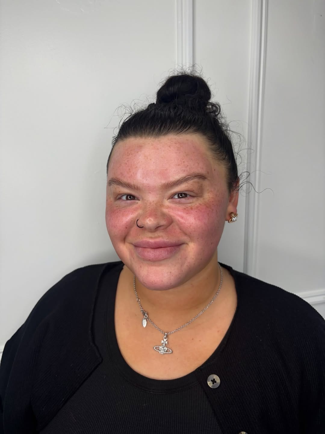 Post 6 by SKIN AESTHETICS & TRAINING | Aleesha Thompson on Instagram (image)