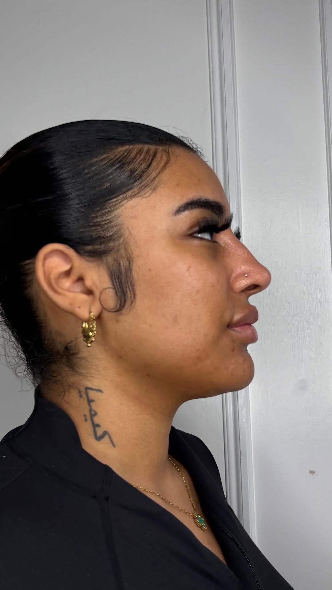 Post 5 by SKIN AESTHETICS & TRAINING | Aleesha Thompson on Instagram (video)