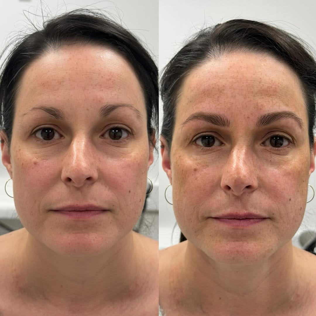 Post 5 by Kathy Brennan Permanent Makeup on Instagram (image)