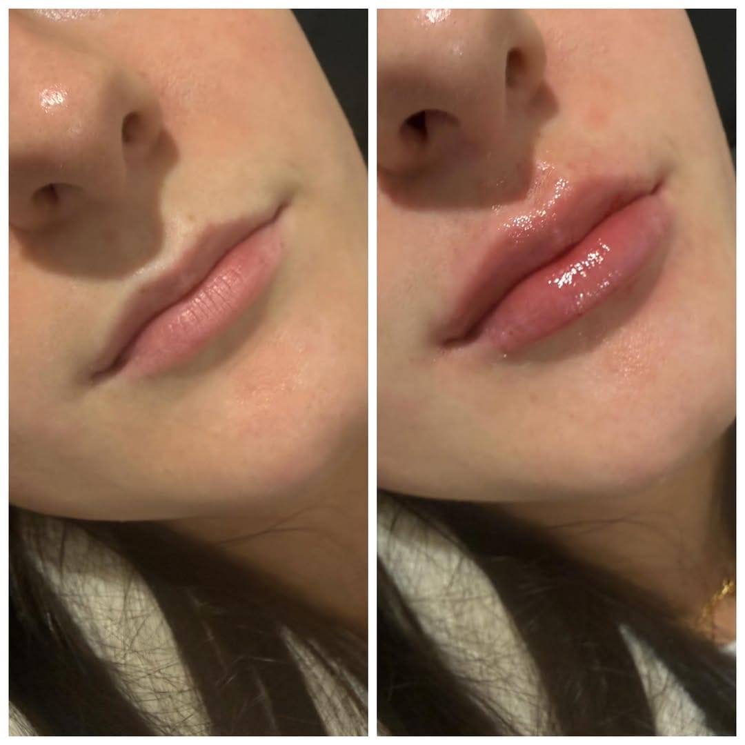 Post 7 by Silk Clinical Aesthetics on Instagram (image)