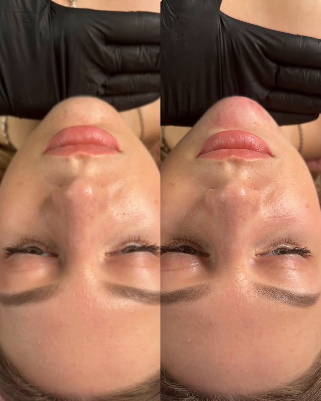 Post 6 by Косметолог Лондон доктор|курси✨Aesthetic practitioner 🇬🇧London on Instagram (image)