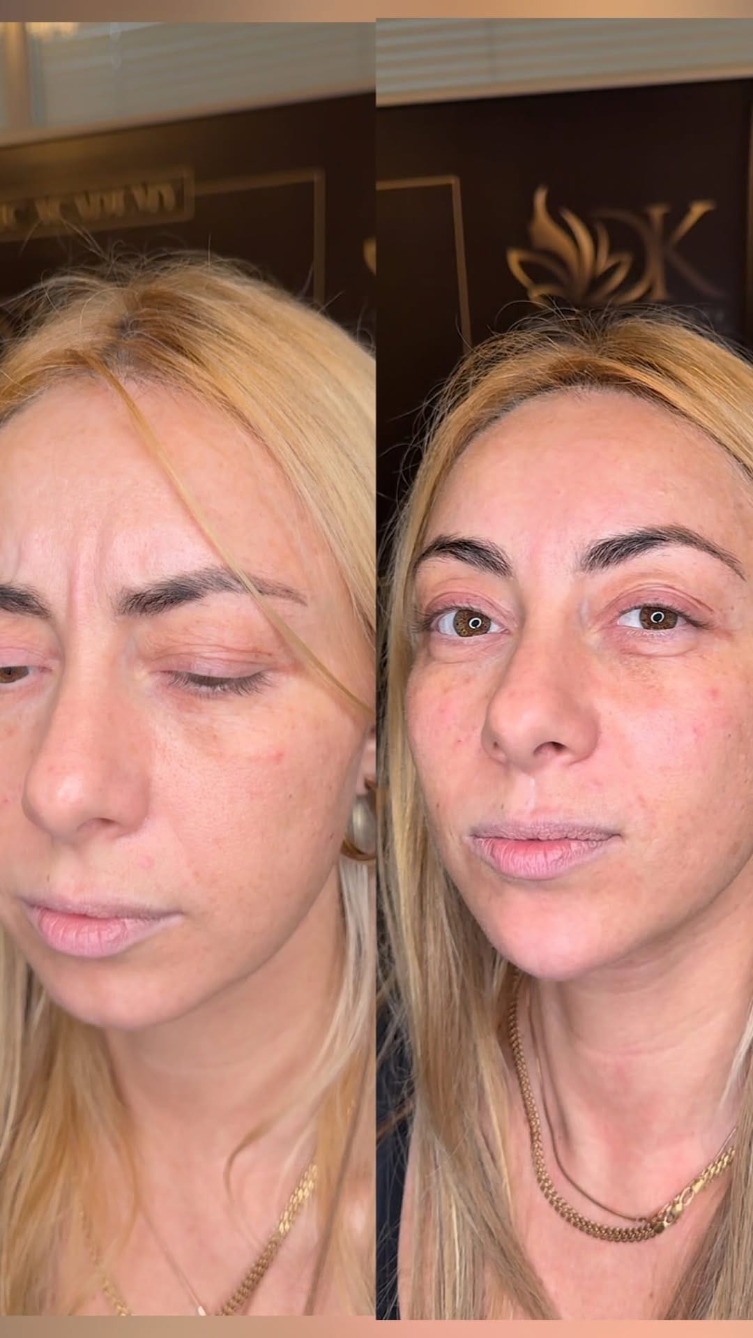 Post 3 by Косметолог Лондон доктор|курси✨Aesthetic practitioner 🇬🇧London on Instagram (video)