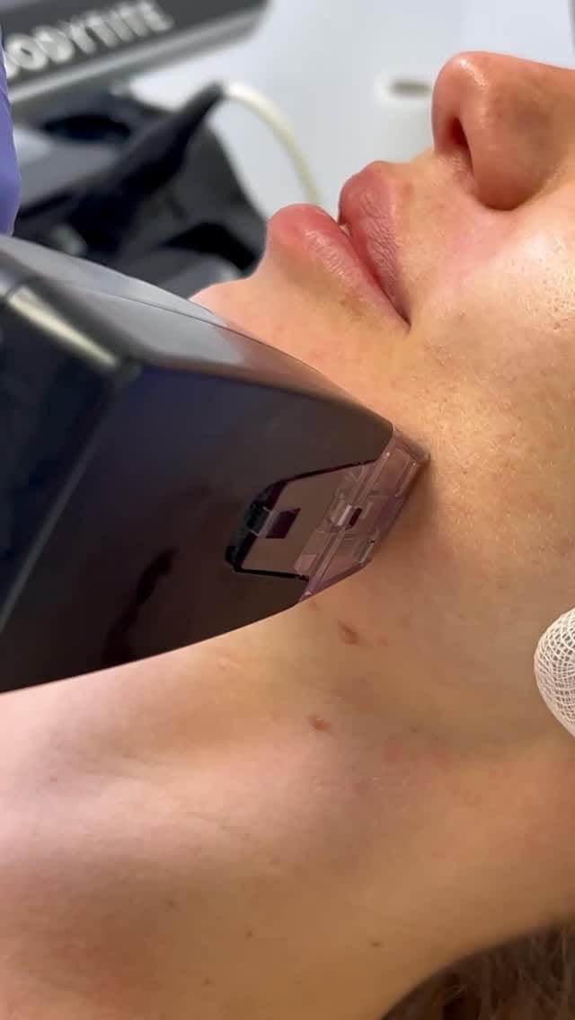 Post 3 by Zenova Medic | Clínica Estética on Instagram (video)