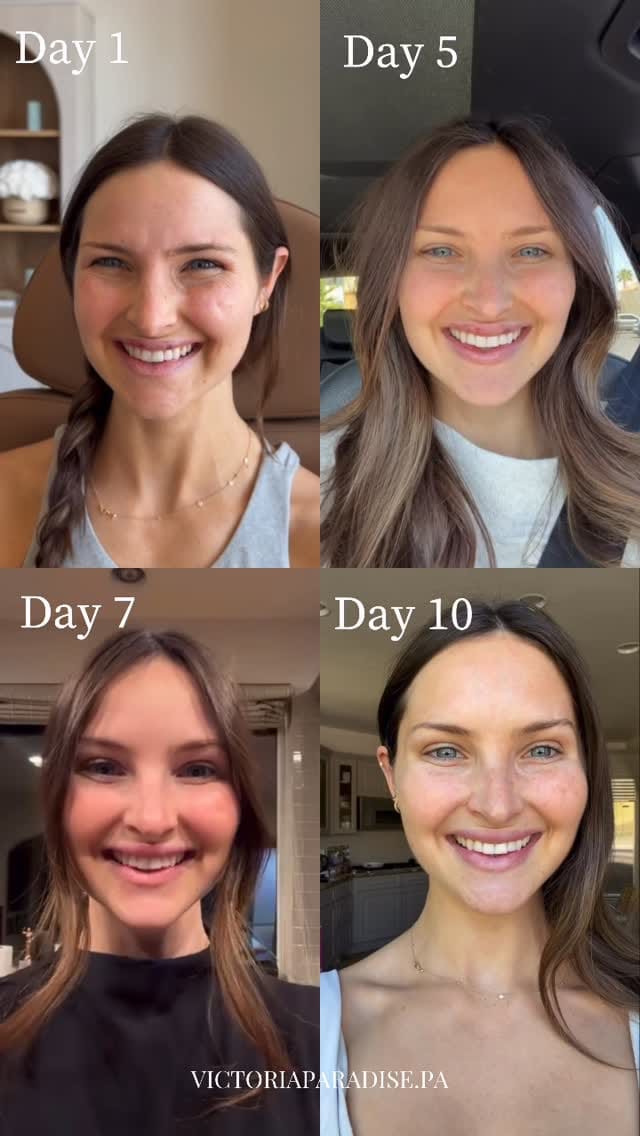 Post 1 by NYC & Las Vegas Botox, Fillers, Skincare on Instagram (video)