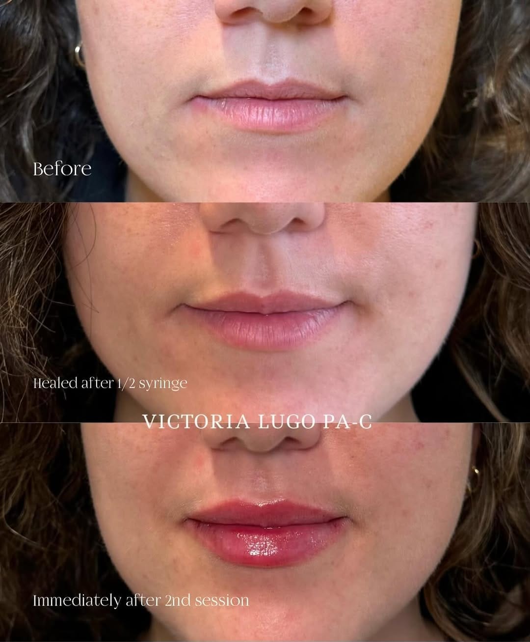 Post 9 by NYC & Las Vegas Botox, Fillers, Skincare on Instagram (carousel)