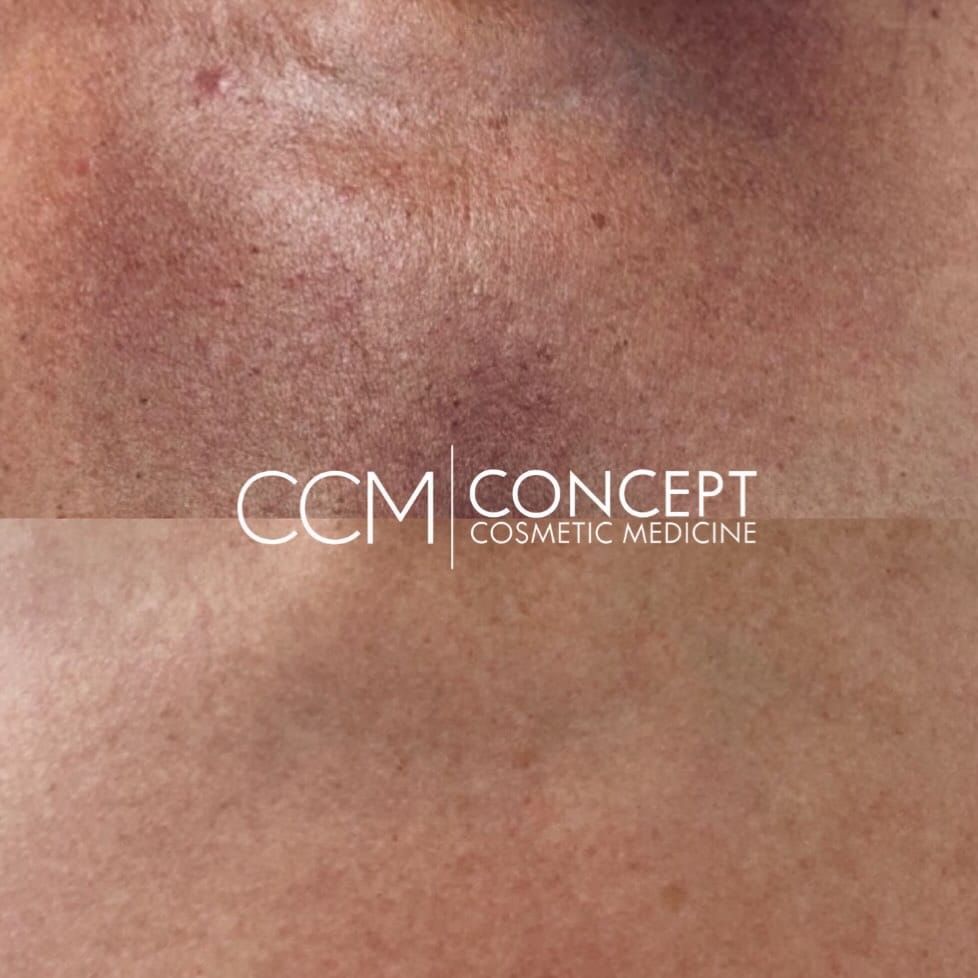 Post 3 by Sydney Aesthetic Clinic on Instagram (image)