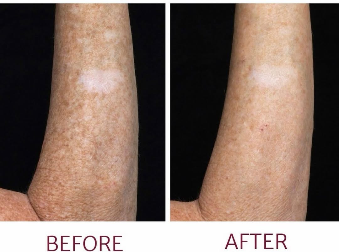 Post 1 by Sydney Aesthetic Clinic on Instagram (image)