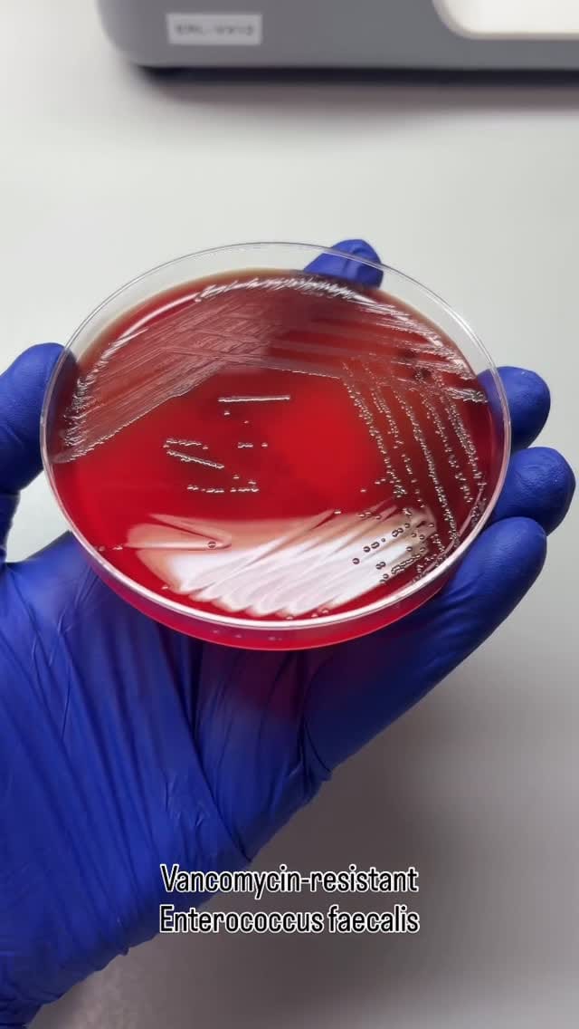Post 1 by Bacteriagram on Instagram (video)