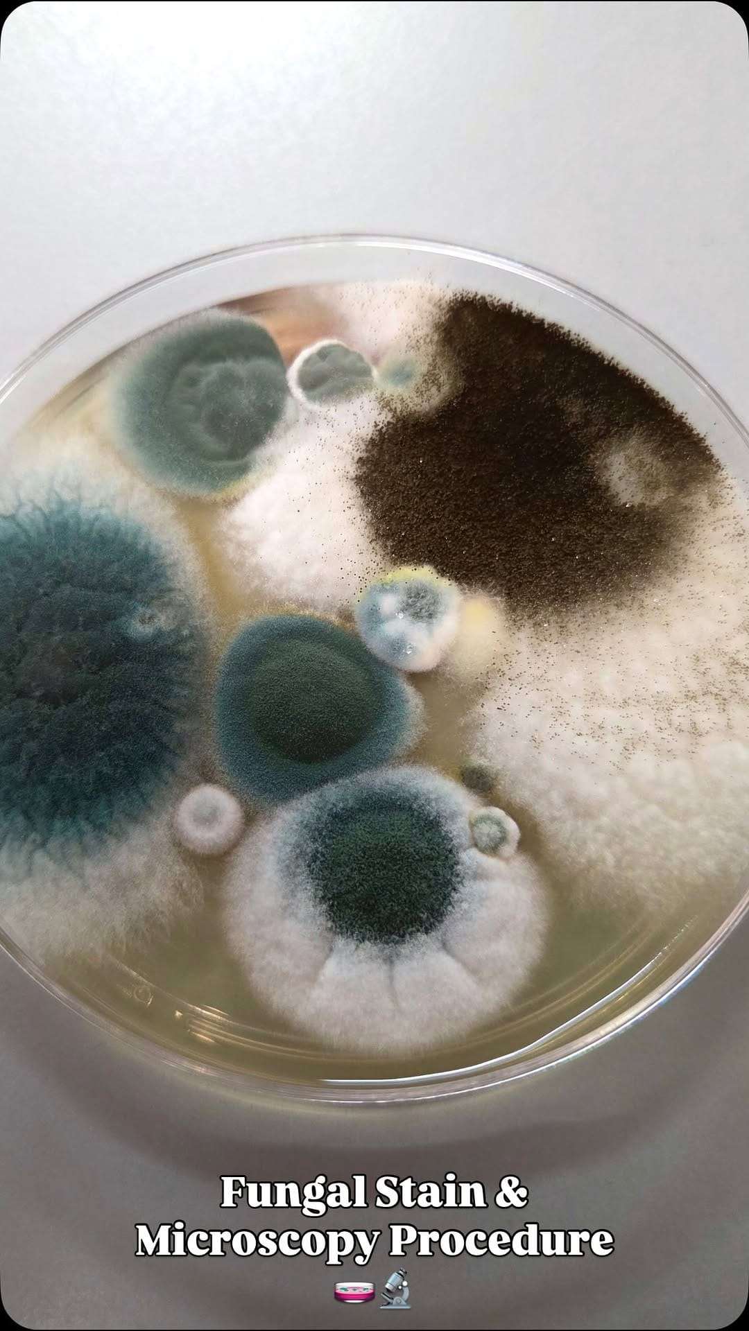 Post 6 by Bacteriagram on Instagram (video)