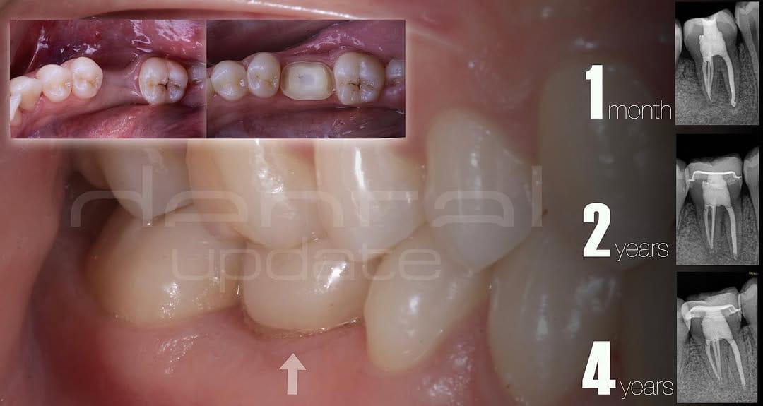 Post 4 by DentalUpdate on Instagram (image)