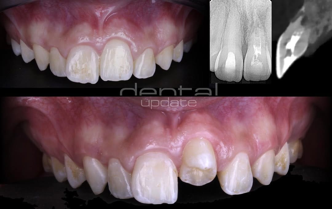 Post 7 by DentalUpdate on Instagram (carousel)
