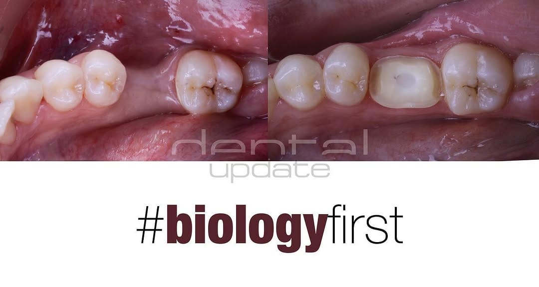 Post 5 by DentalUpdate on Instagram (image)