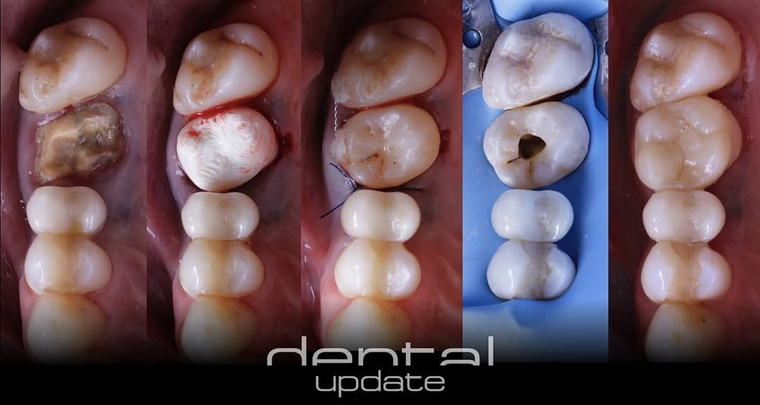 Post 9 by DentalUpdate on Instagram (image)