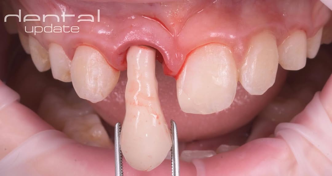 Post 10 by DentalUpdate on Instagram (image)