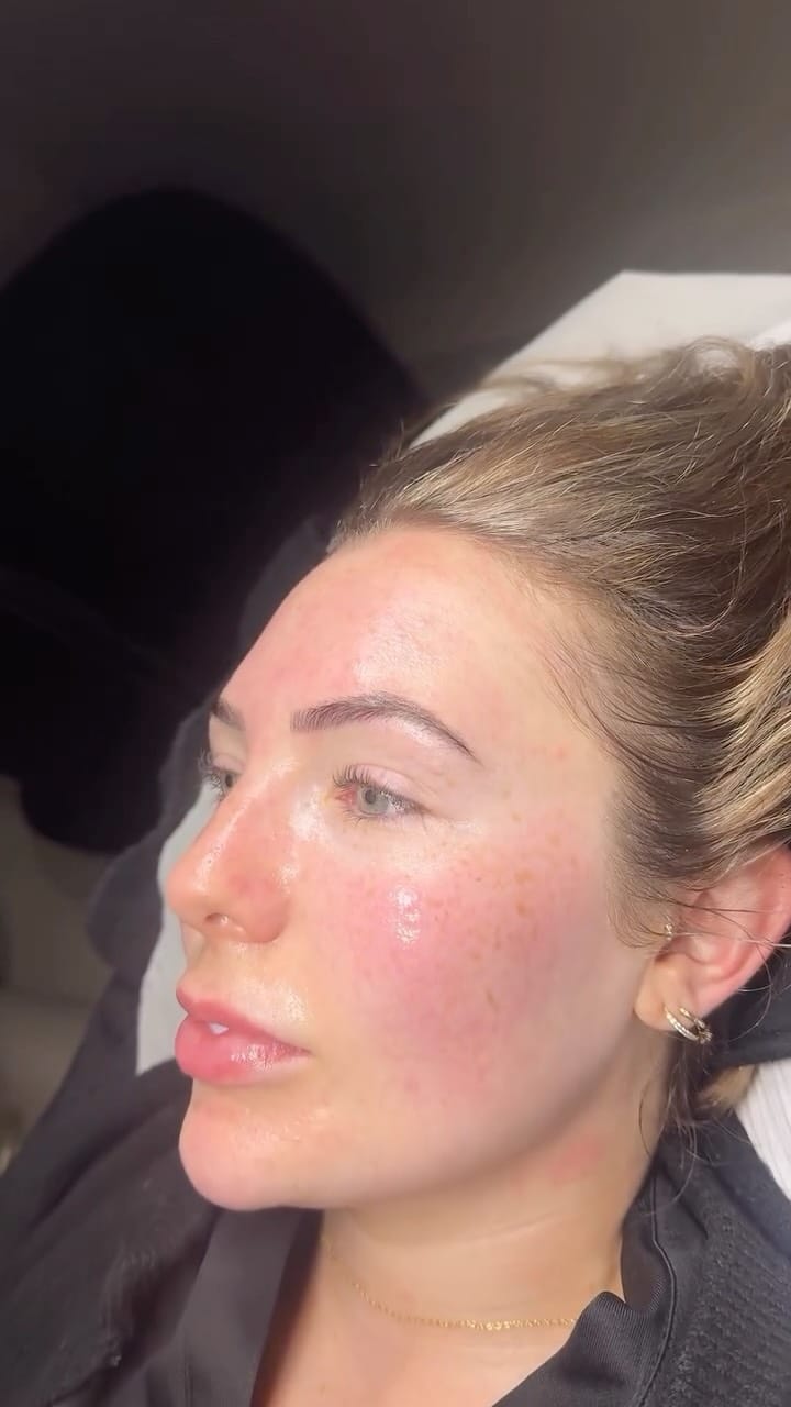Post 4 by SkinGlow By Sophie on Instagram (video)