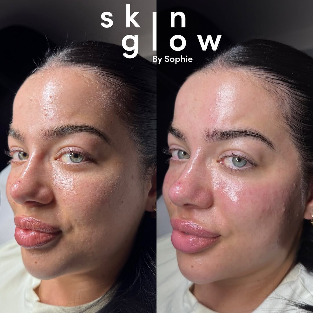 Post 3 by SkinGlow By Sophie on Instagram (image)
