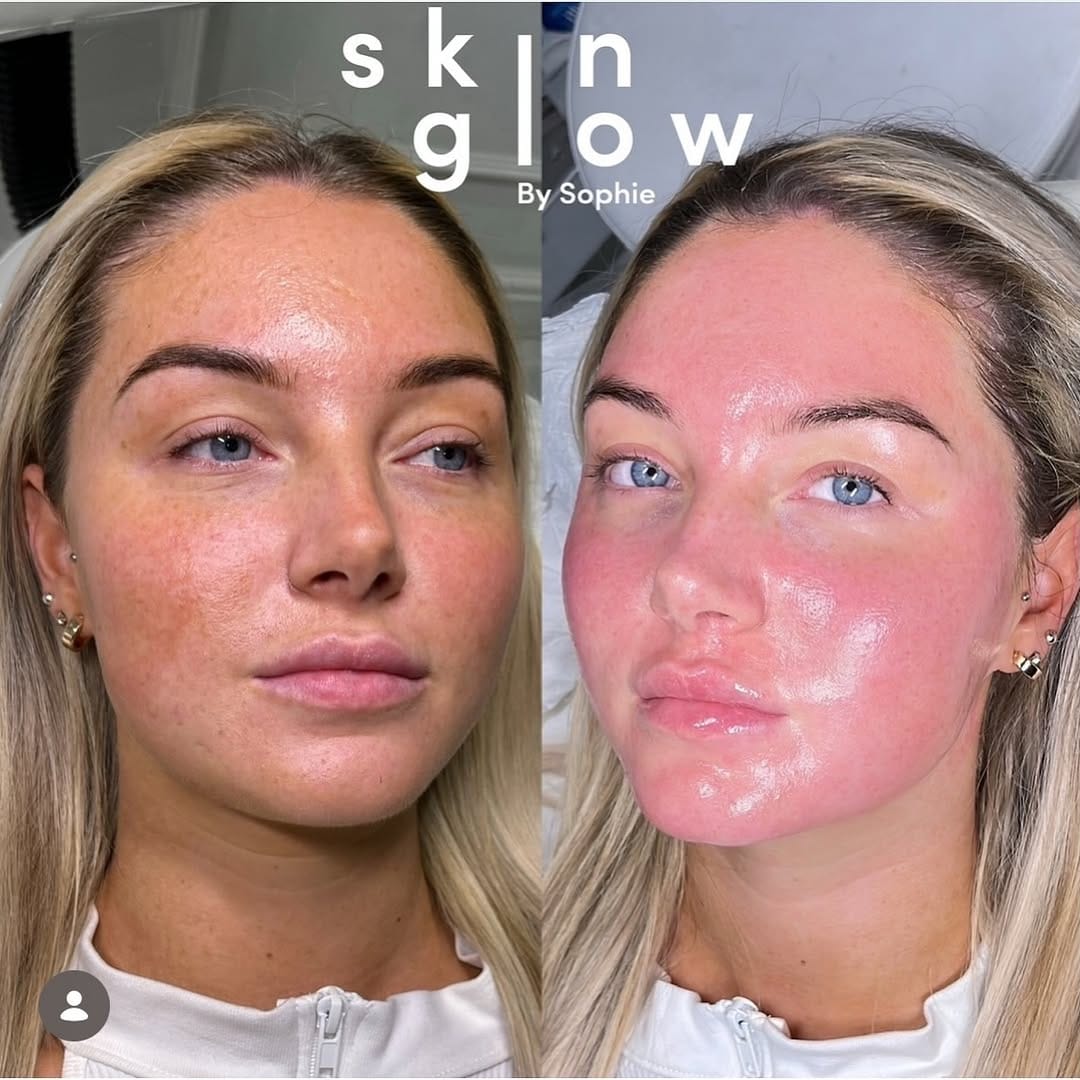 Post 9 by SkinGlow By Sophie on Instagram (image)
