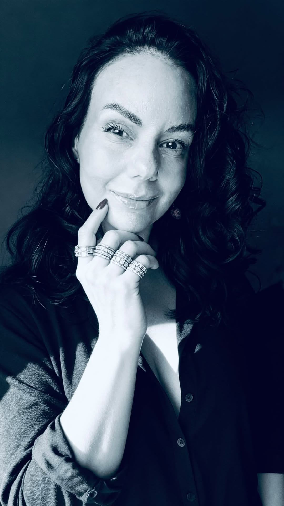 Post 3 by Laura Vierma Martínez / Cirujano Bucal y Maxilofacial on Instagram (video)