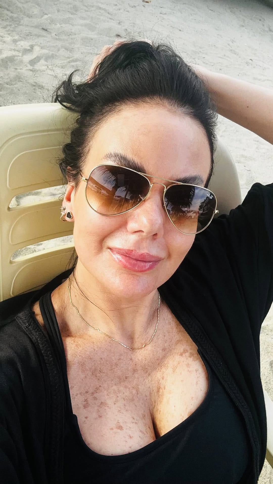 Post 1 by Laura Vierma Martínez / Cirujano Bucal y Maxilofacial on Instagram (video)