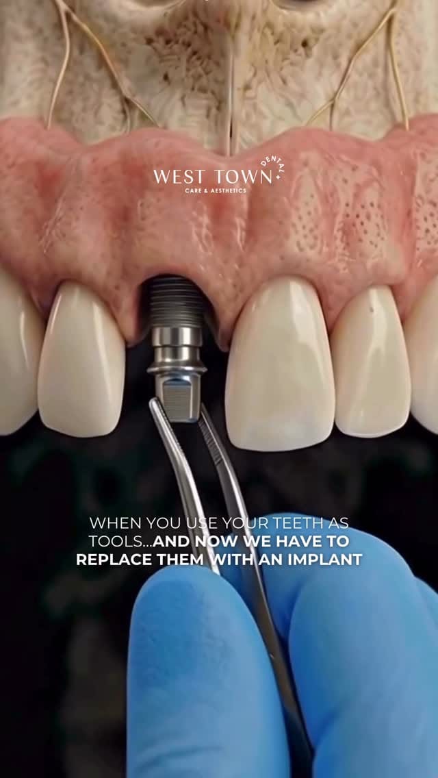 Post 8 by West Town Dental Care on Instagram (video)