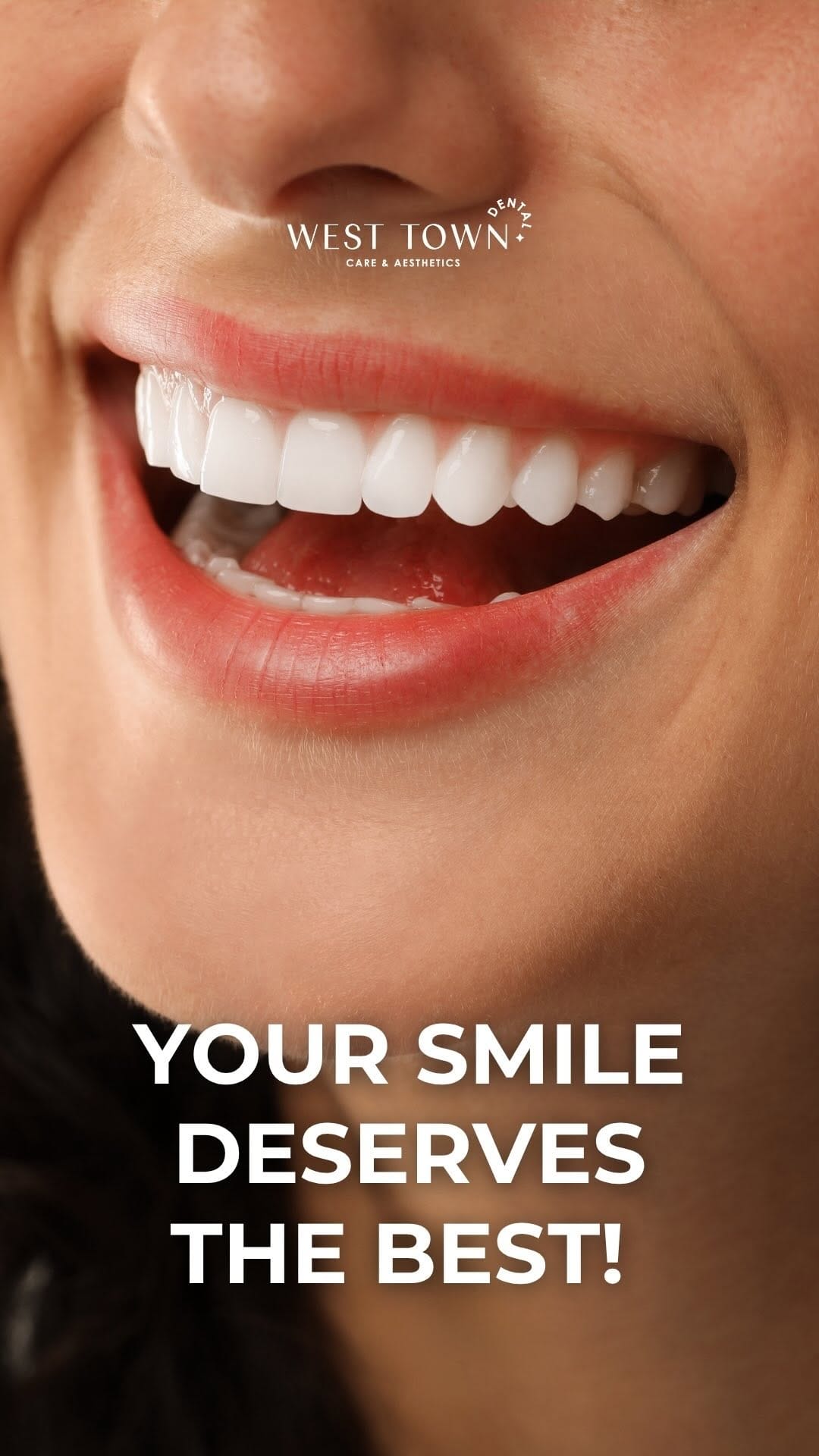 Post 6 by West Town Dental Care on Instagram (video)