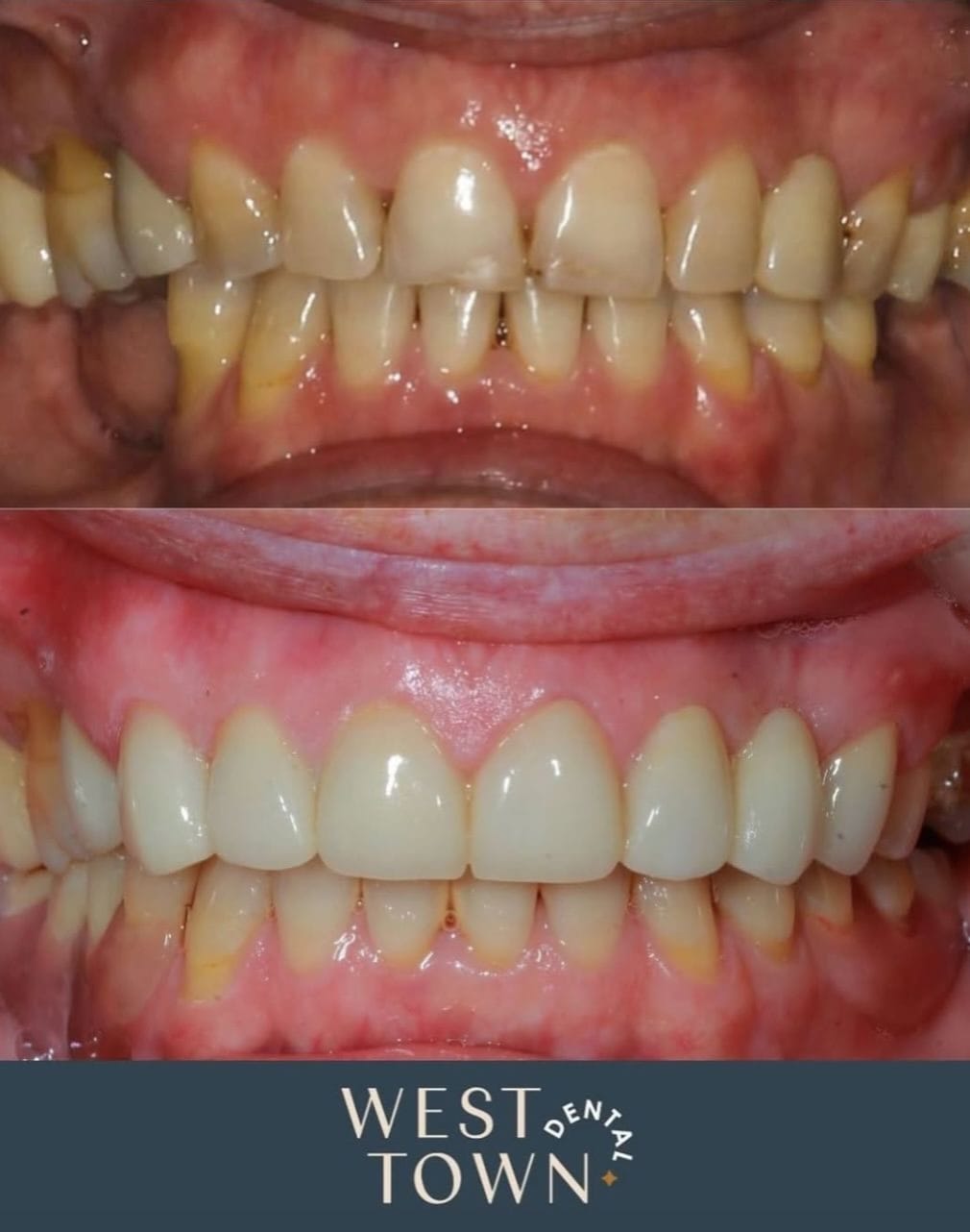 Post 2 by West Town Dental Care on Instagram (image)