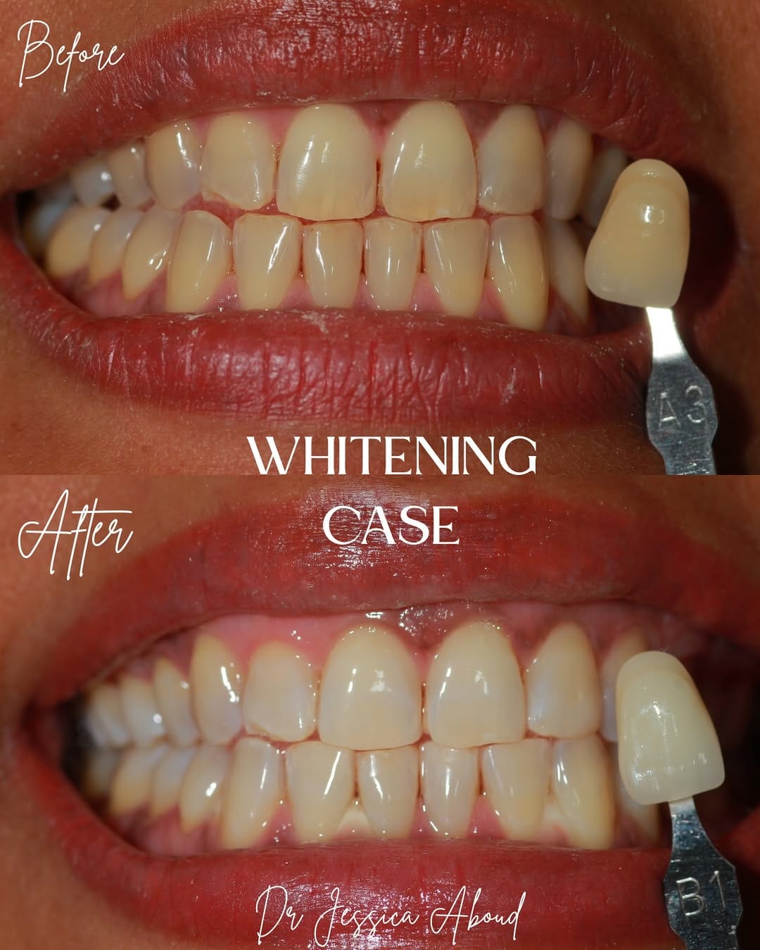 Post 9 by West Town Dental Care on Instagram (image)