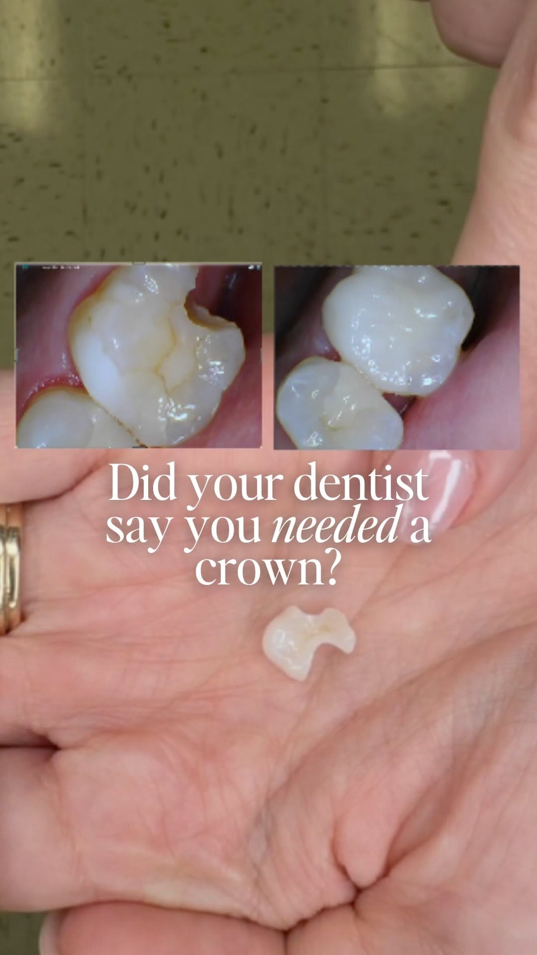 Post 3 by San Antonio Cosmetic Dentist | 5 Star Dental Group on Instagram (video)
