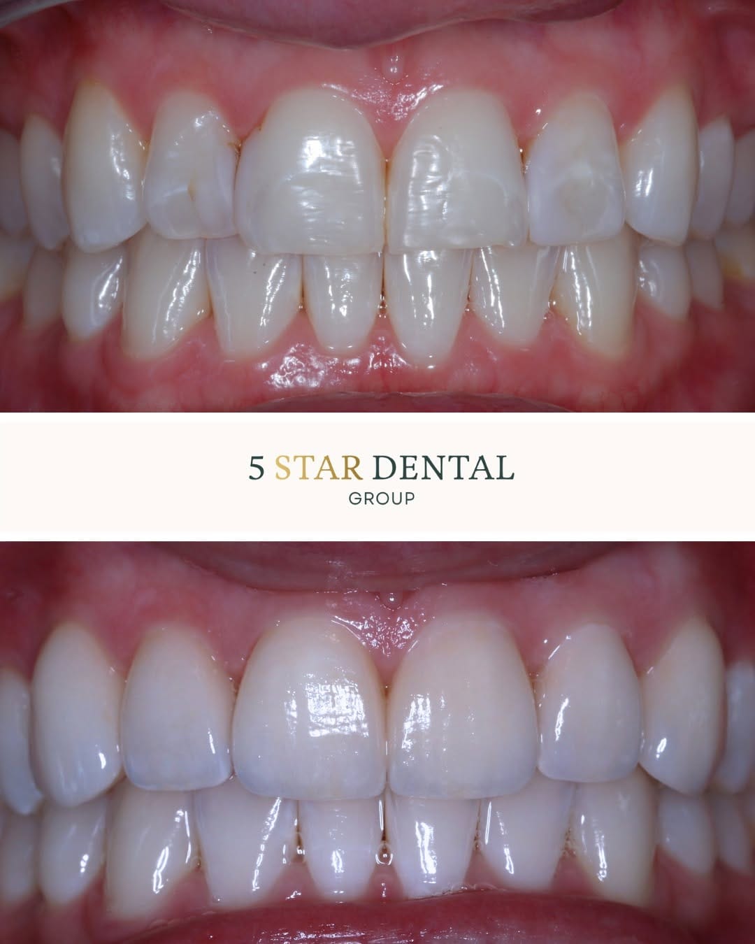 Post 6 by San Antonio Cosmetic Dentist | 5 Star Dental Group on Instagram (image)