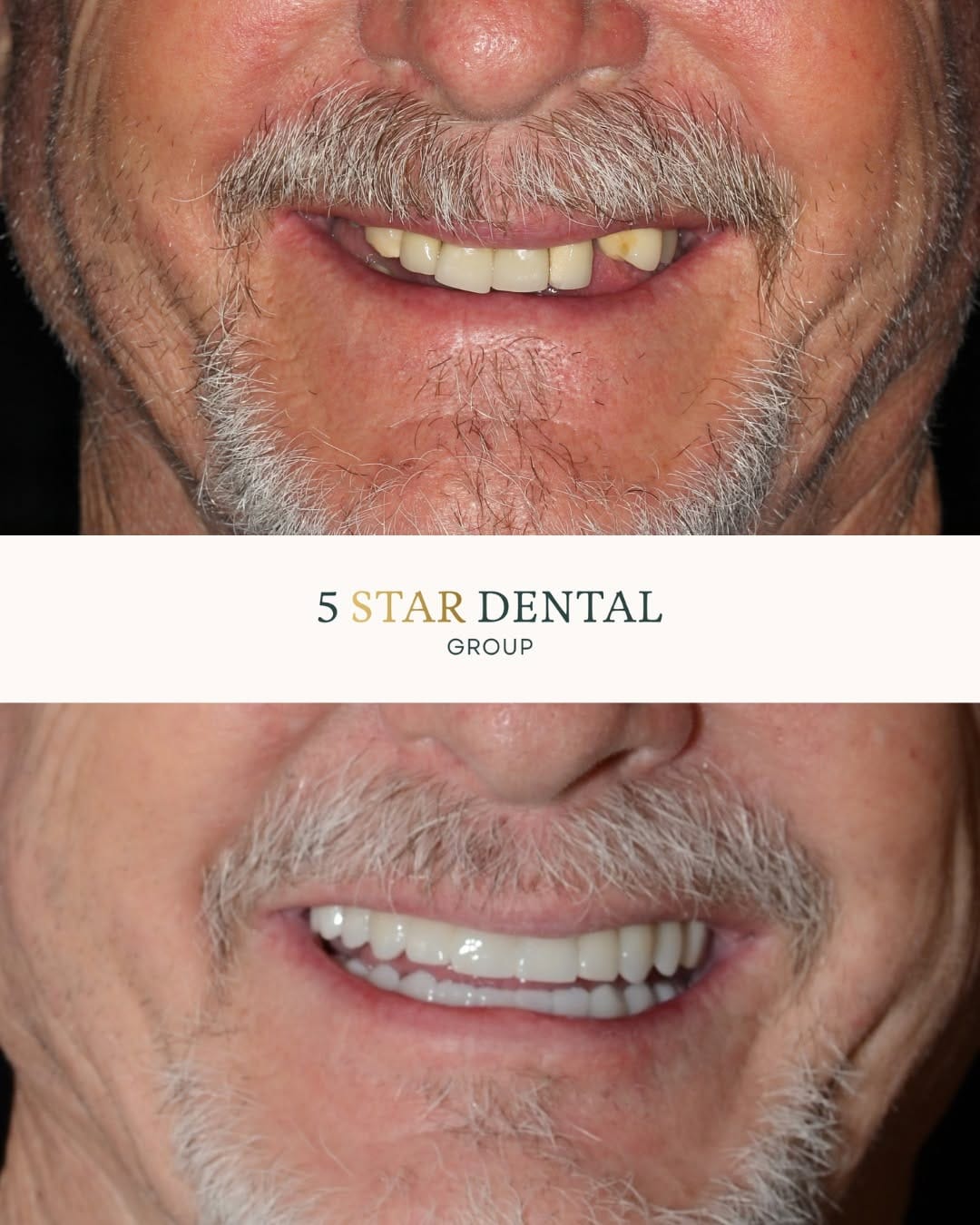 Post 2 by San Antonio Cosmetic Dentist | 5 Star Dental Group on Instagram (image)