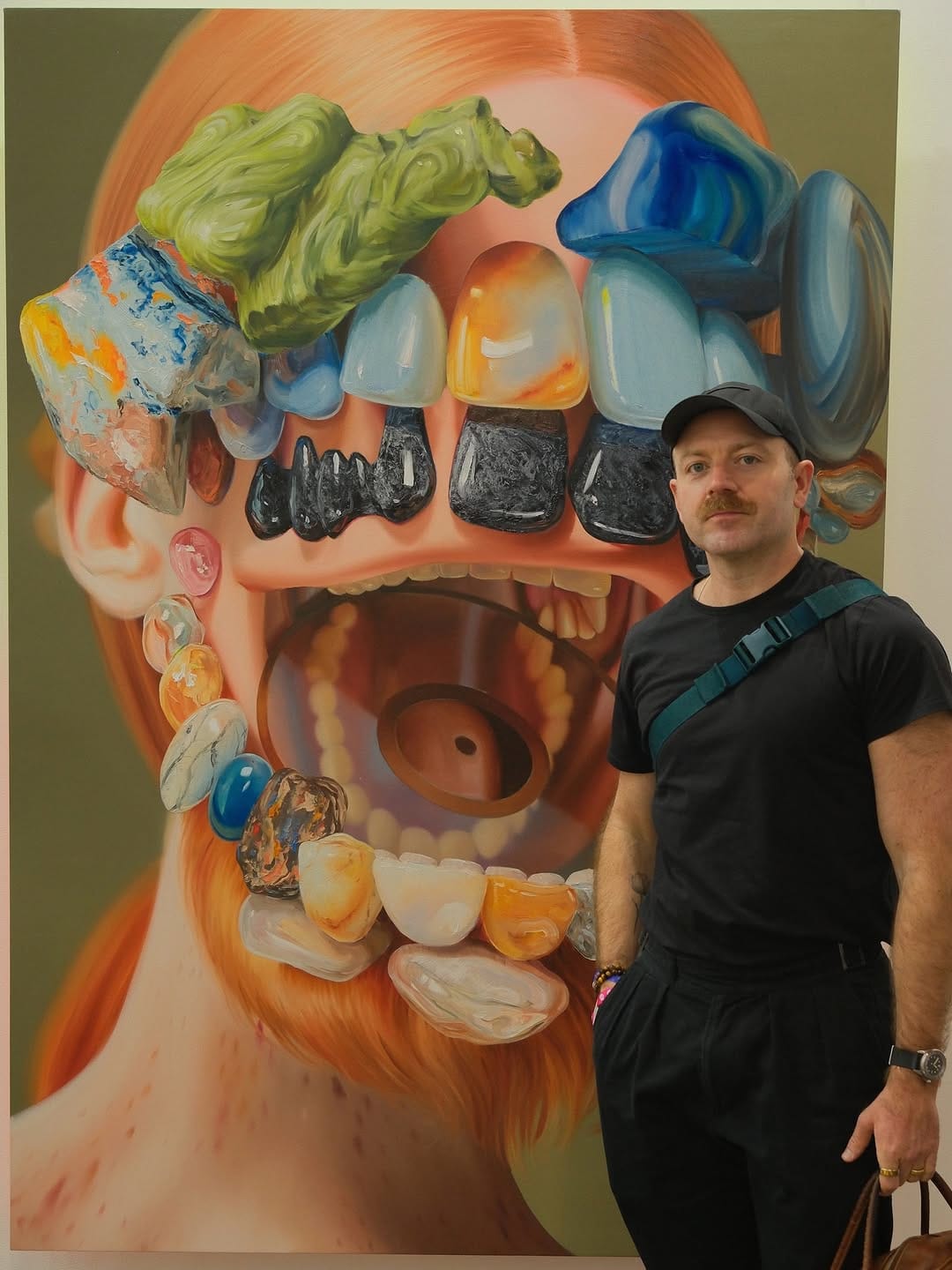 Post 9 by Dr. David Wagner | Veneer Expert on Instagram (carousel)
