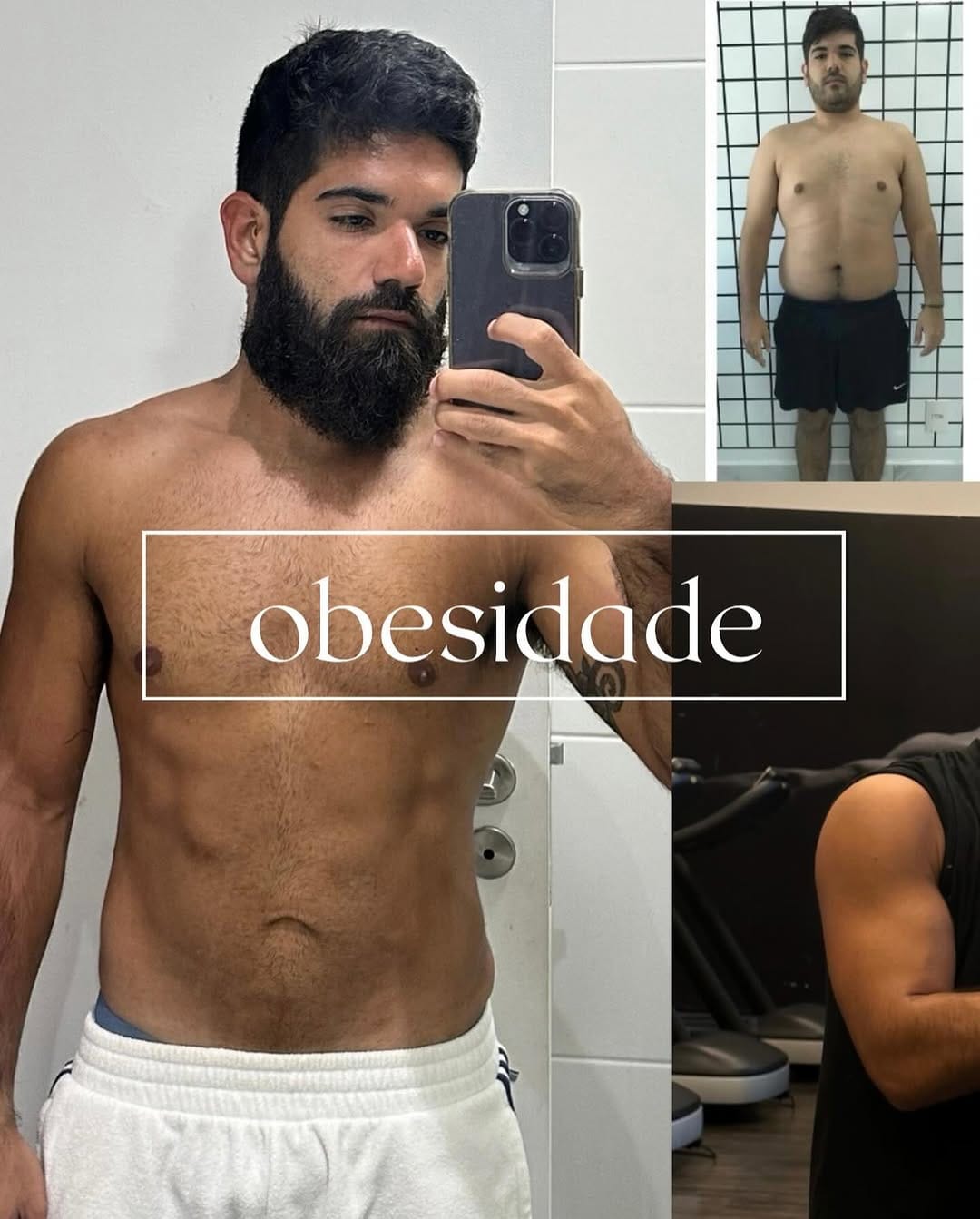 Post 10 by Dr. Gustavo Rosa • Nutrólogo • CRMMG 81179 RQE’s 54623/68435 on Instagram (carousel)