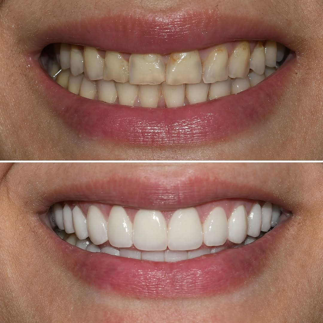 Post 9 by Dr. Hailat | Houston Dentist on Instagram (carousel)