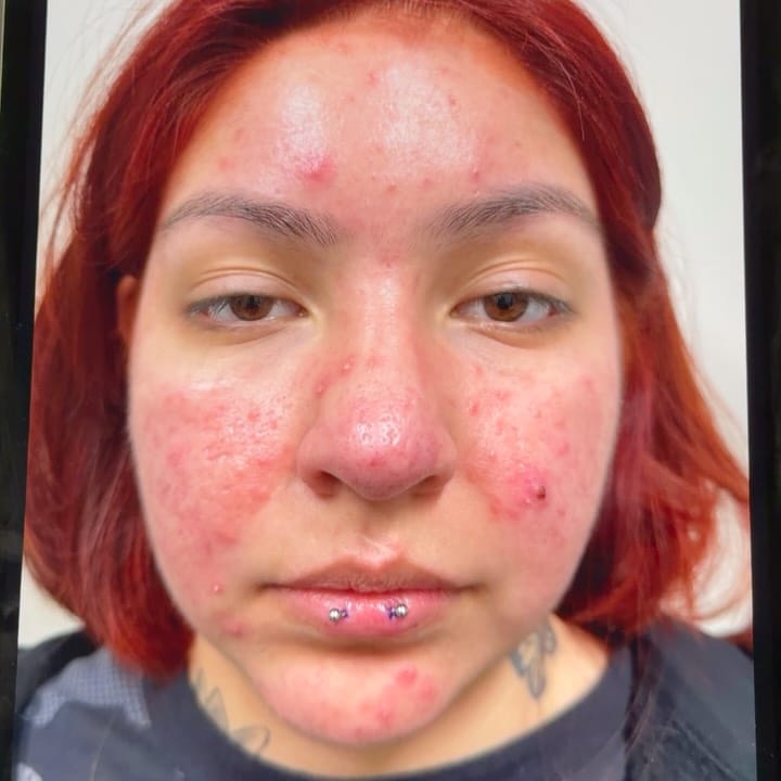 Post 2 by Ken Dela Paz | Chicago Esthetician on Instagram (carousel)