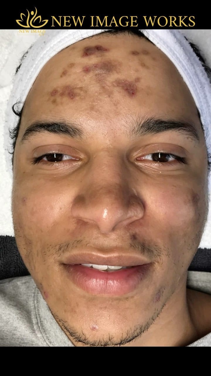 Post 8 by Ken Dela Paz | Chicago Esthetician on Instagram (video)