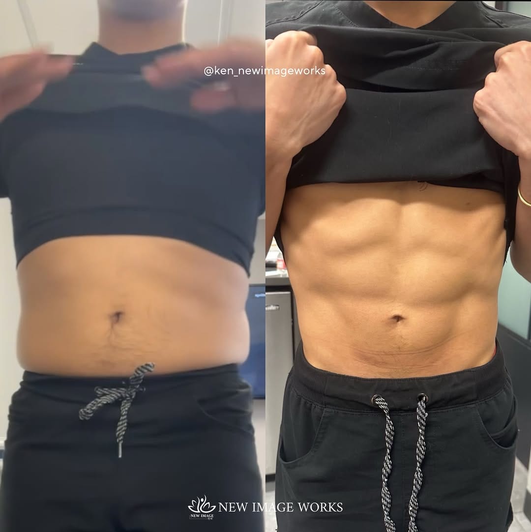 Post 4 by Ken Dela Paz | Chicago Esthetician on Instagram (image)