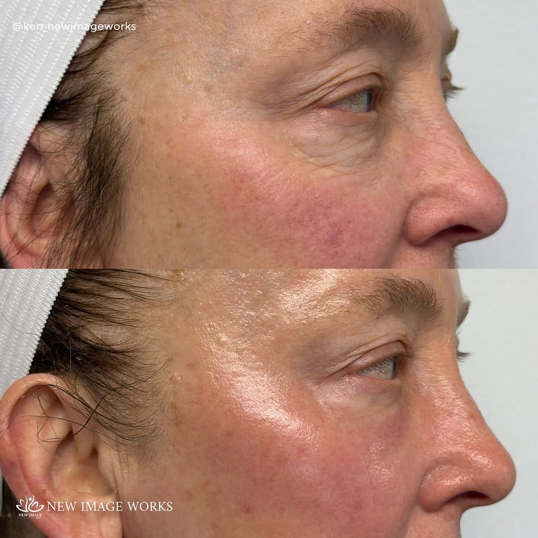 Post 3 by Ken Dela Paz | Chicago Esthetician on Instagram (carousel)
