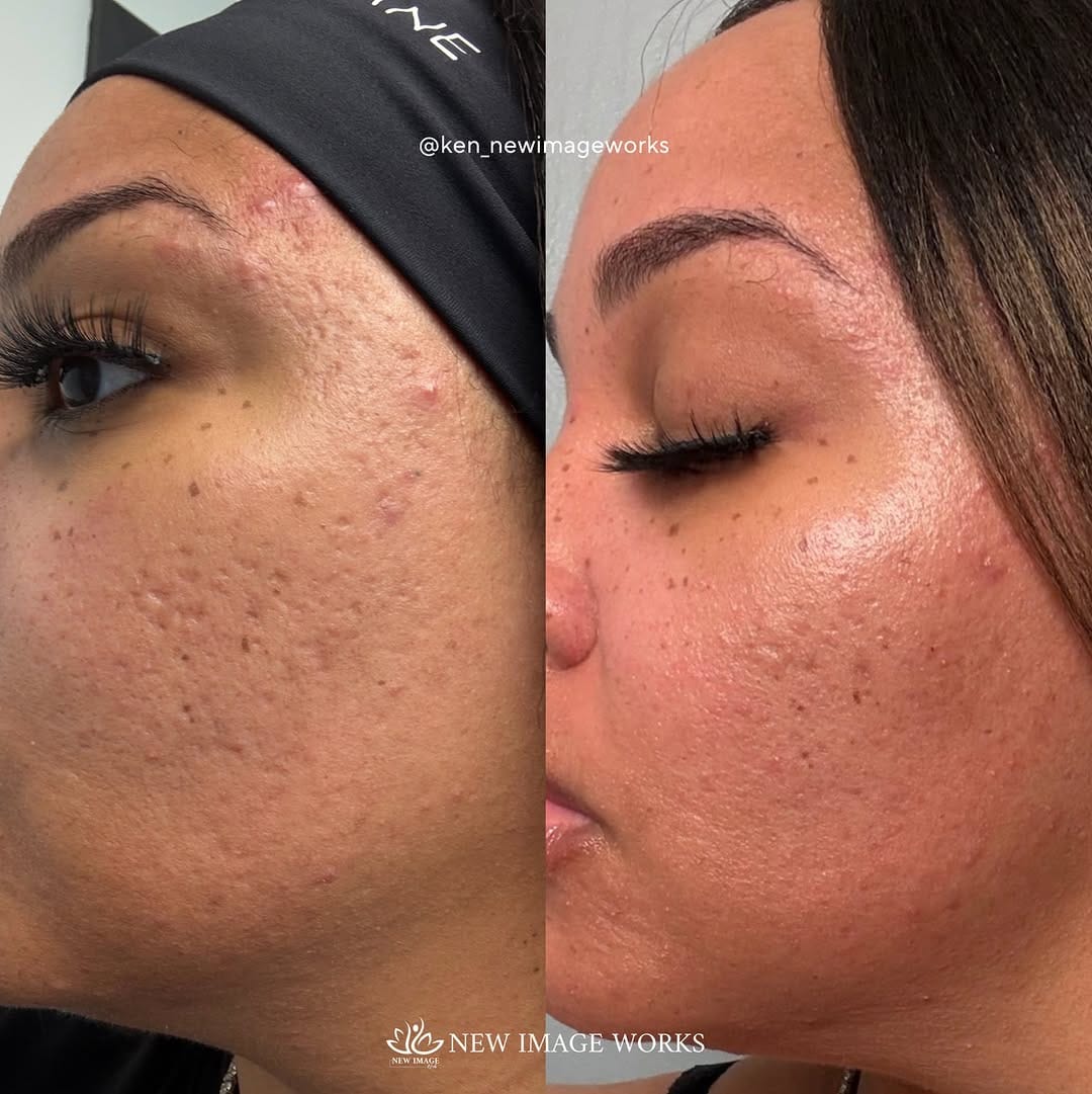 Post 1 by Ken Dela Paz | Chicago Esthetician on Instagram (carousel)