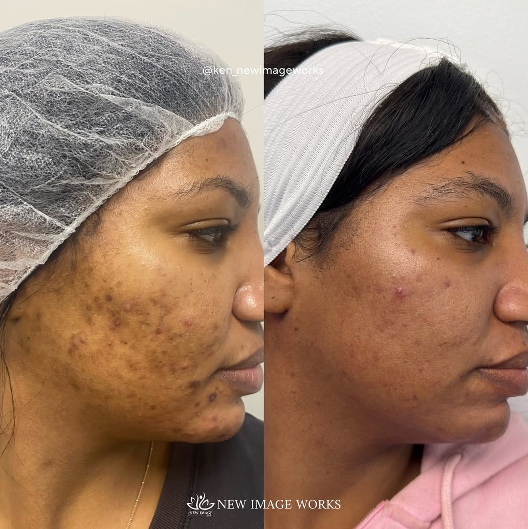 Post 5 by Ken Dela Paz | Chicago Esthetician on Instagram (carousel)