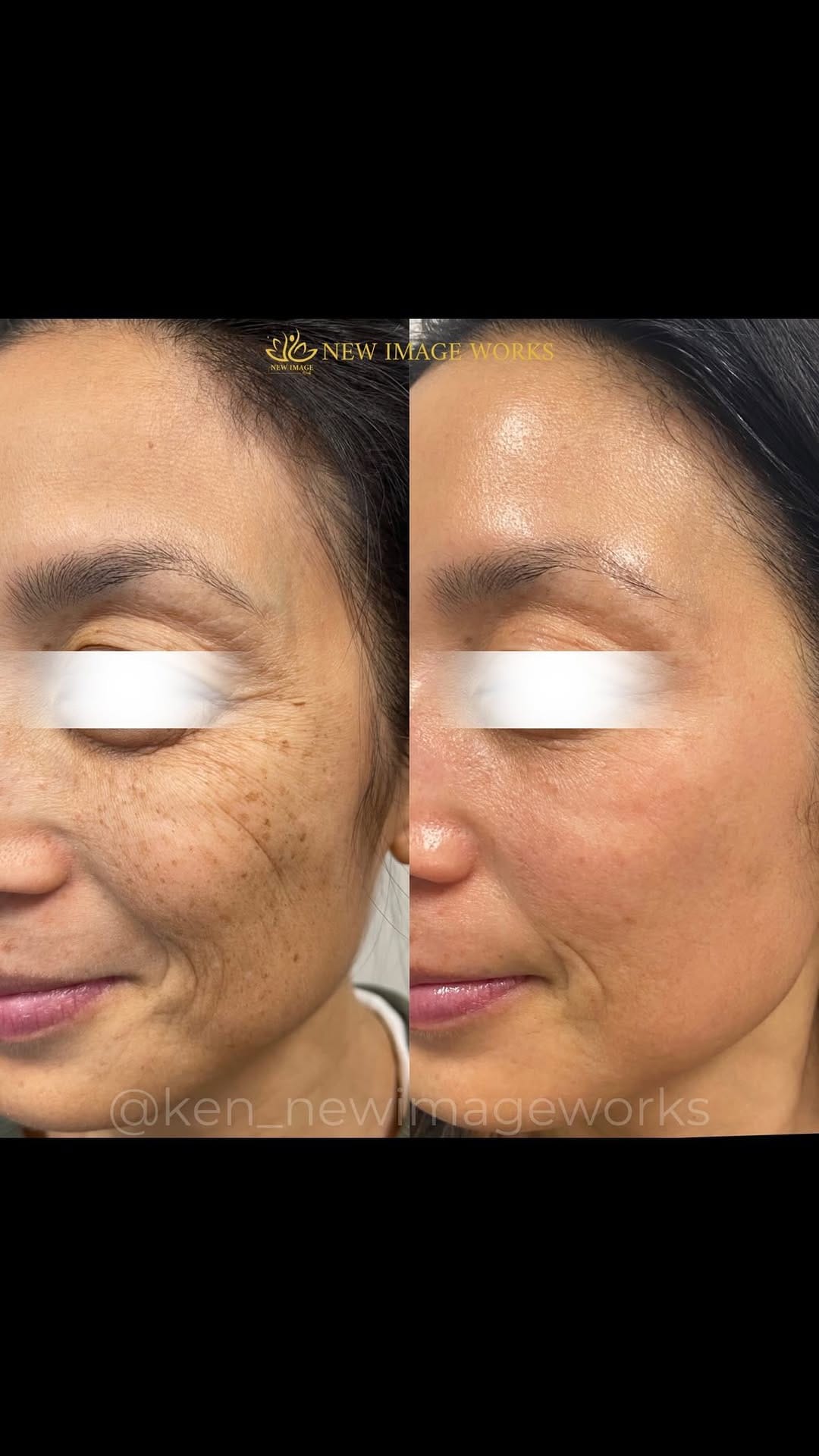 Post 10 by Ken Dela Paz | Chicago Esthetician on Instagram (video)