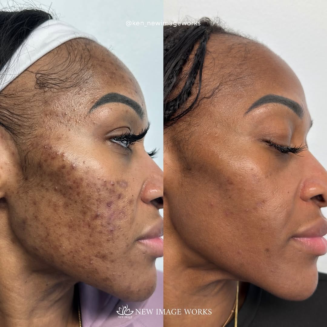 Post 7 by Ken Dela Paz | Chicago Esthetician on Instagram (carousel)