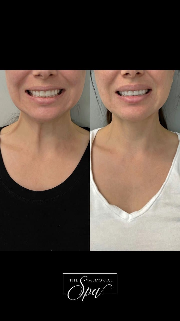 Post 10 by The Memorial Spa on Instagram (video)