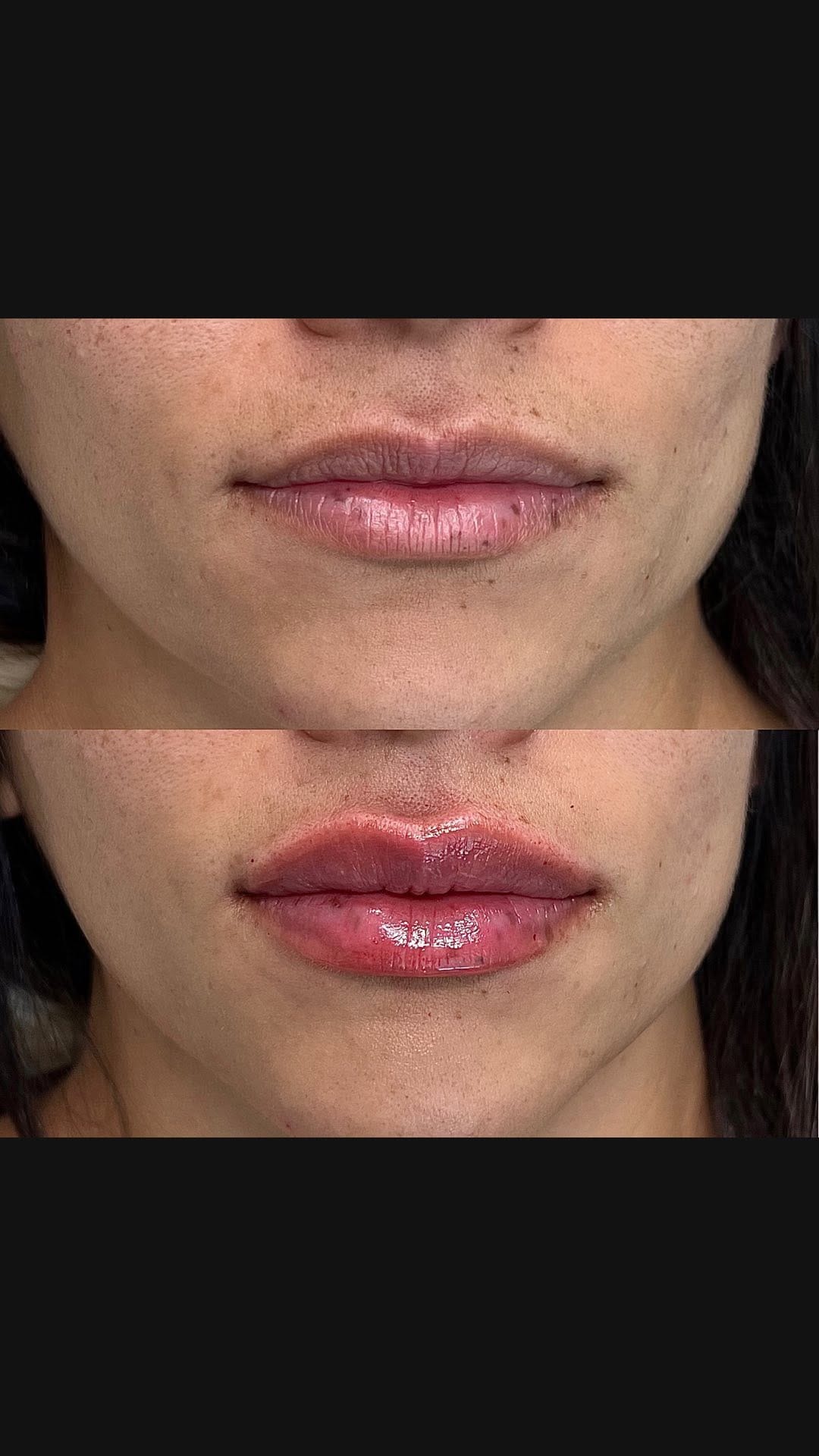 Post 3 by The Memorial Spa on Instagram (video)