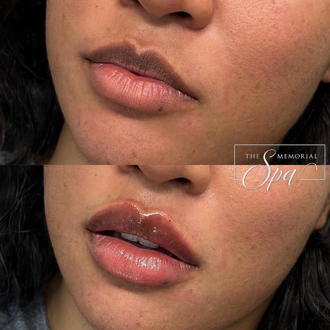 Post 1 by The Memorial Spa on Instagram (image)