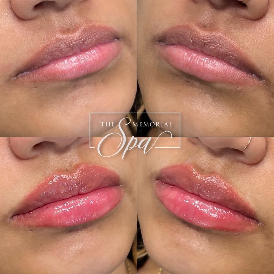 Post 7 by The Memorial Spa on Instagram (image)