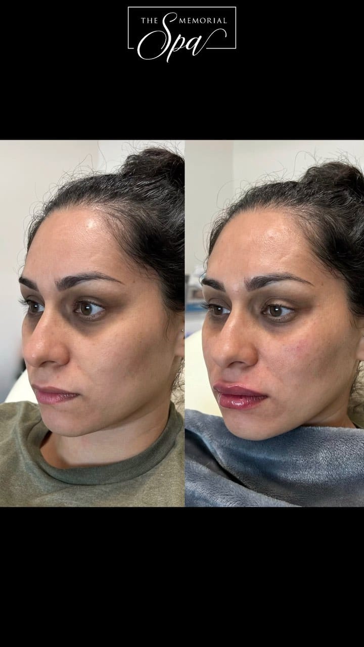Post 6 by The Memorial Spa on Instagram (video)