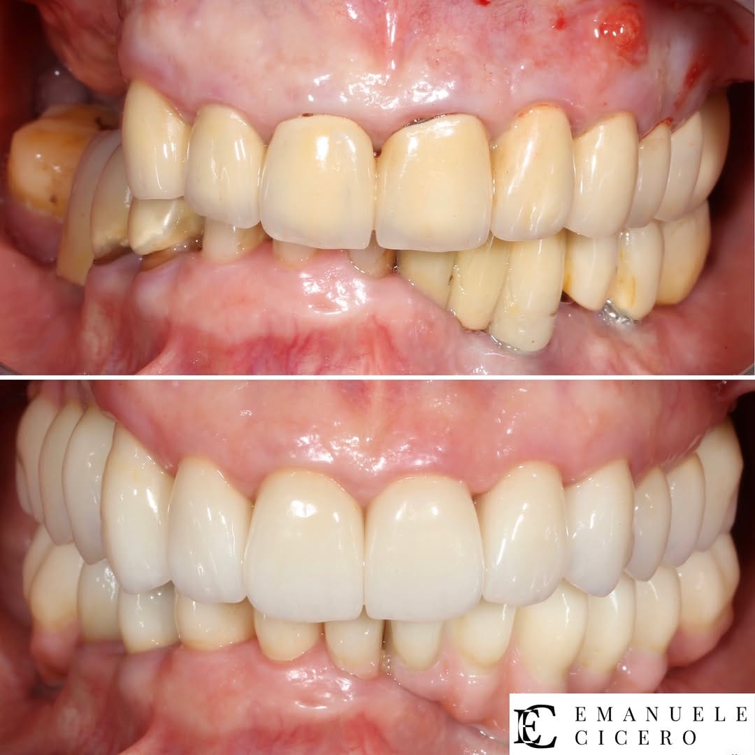 Post 1 by Dr. Emanuele Cicero, DDS, FACP on Instagram (carousel)