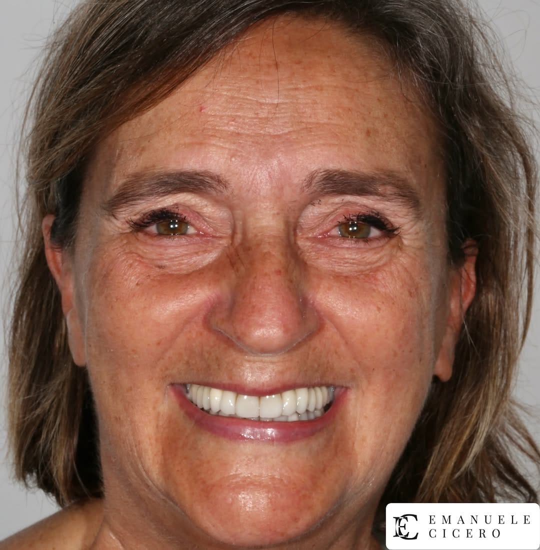 Post 3 by Dr. Emanuele Cicero, DDS, FACP on Instagram (carousel)